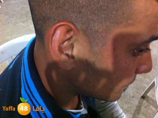 phoneludinjury (8).JPG